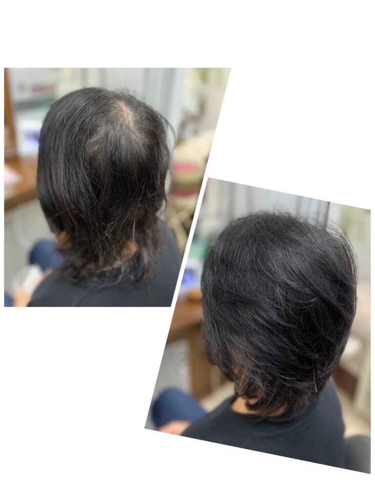 レイヤーカット