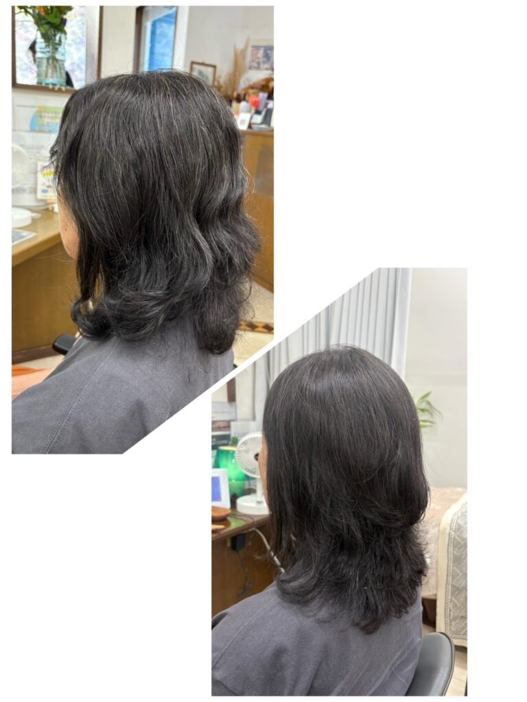 部分矯正でボリュームダウン