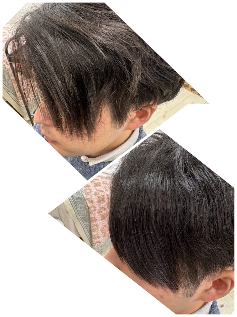 フェイスラインを縮毛矯正