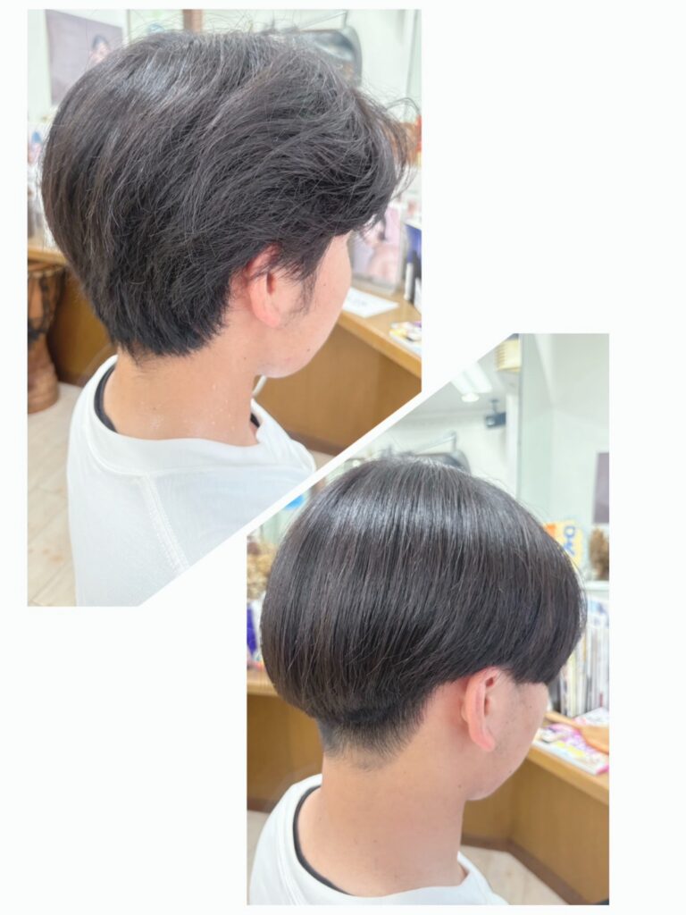 ご新規!部分矯正(高校生)